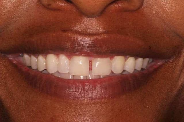 Before - Case 2